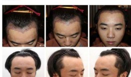 成都整形爆料事件最新,揭秘行业乱象与患者权益受损真相