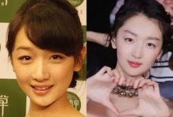 林志玲美白针爆料视频大全,视频大全带你探秘明星美容秘籍